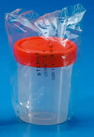 POT A URINE STERILE