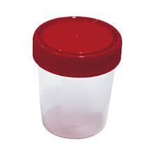 POT A URINE NON STERILE